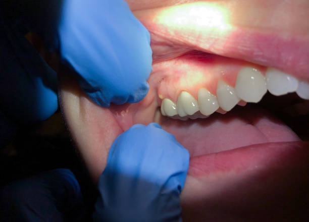 Best Emergency Dental Care for Trauma or Injury in Louisville, MS